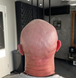 Shaved Head Maintenance Routine for Healthy Skin and Scalp 2 shaved head