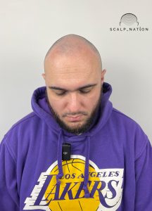 AFTER Studio Light Front 39