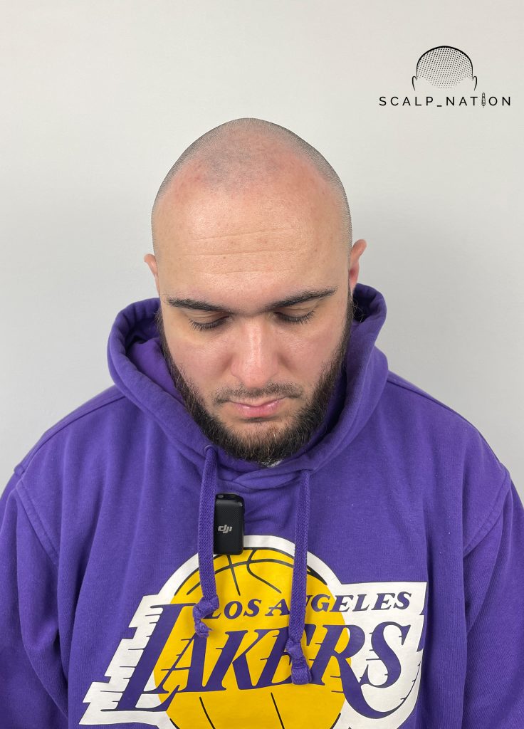 AFTER Studio Light Front 39