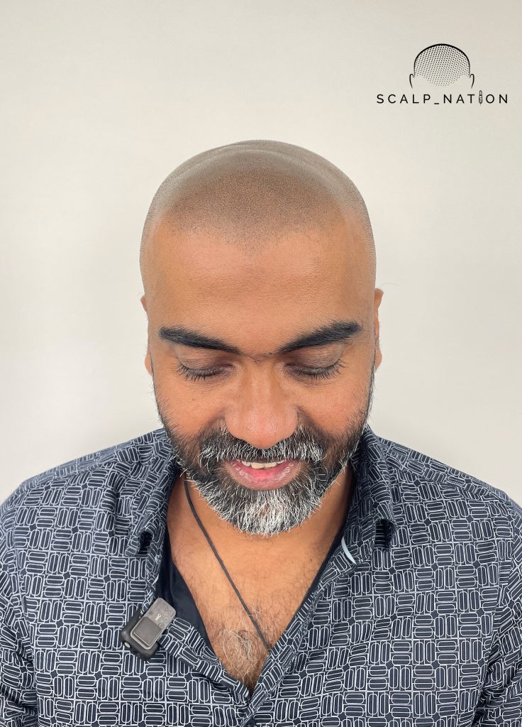 AFTER Studio Light Front 40