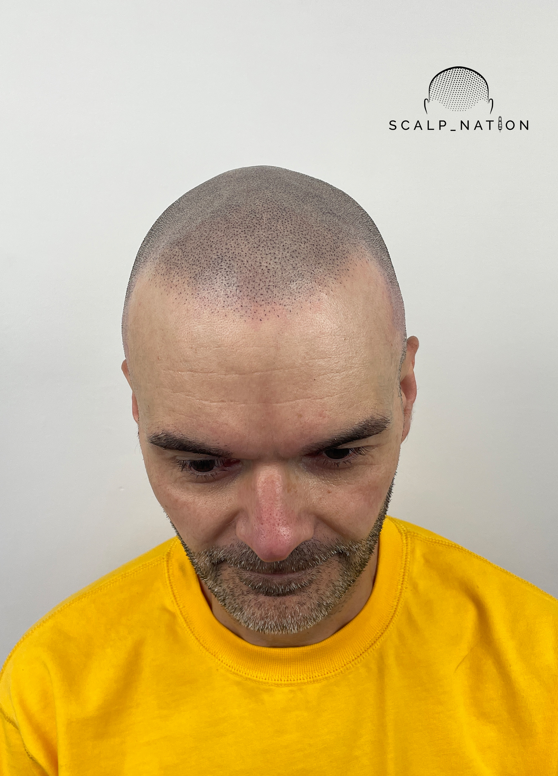 After image alt