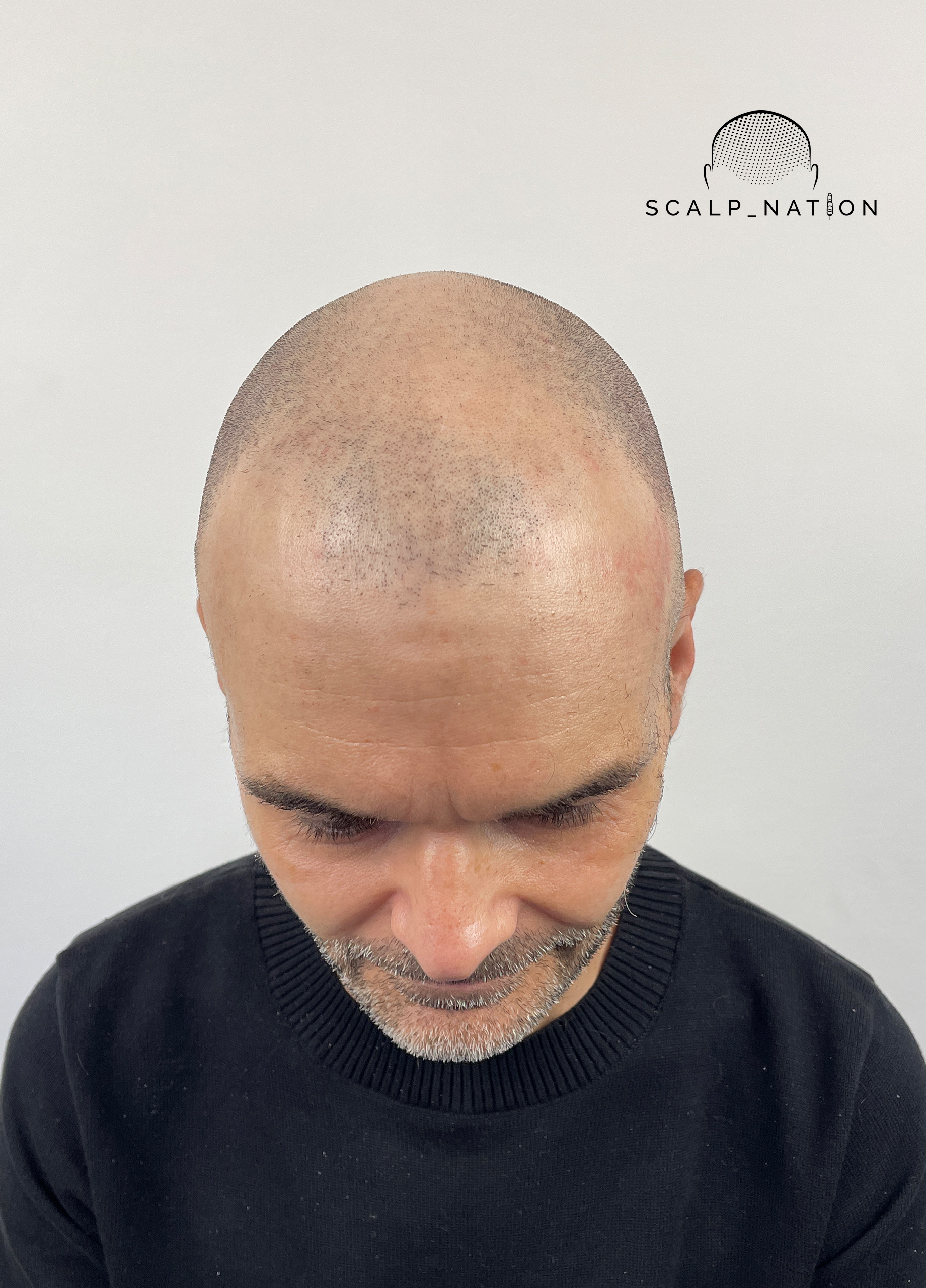 Before image alt