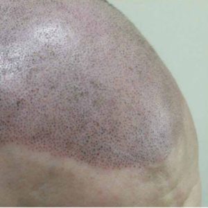 Fresh SMP vs Healed SMP: Understanding the SMP Process 1 smp style