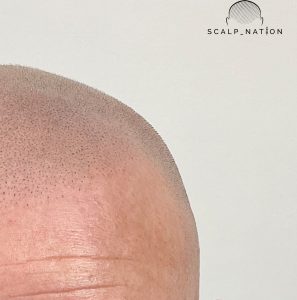 Bald Style Trends That Redefine Confidence and Fashion 9 GV Close Up e1763740548604