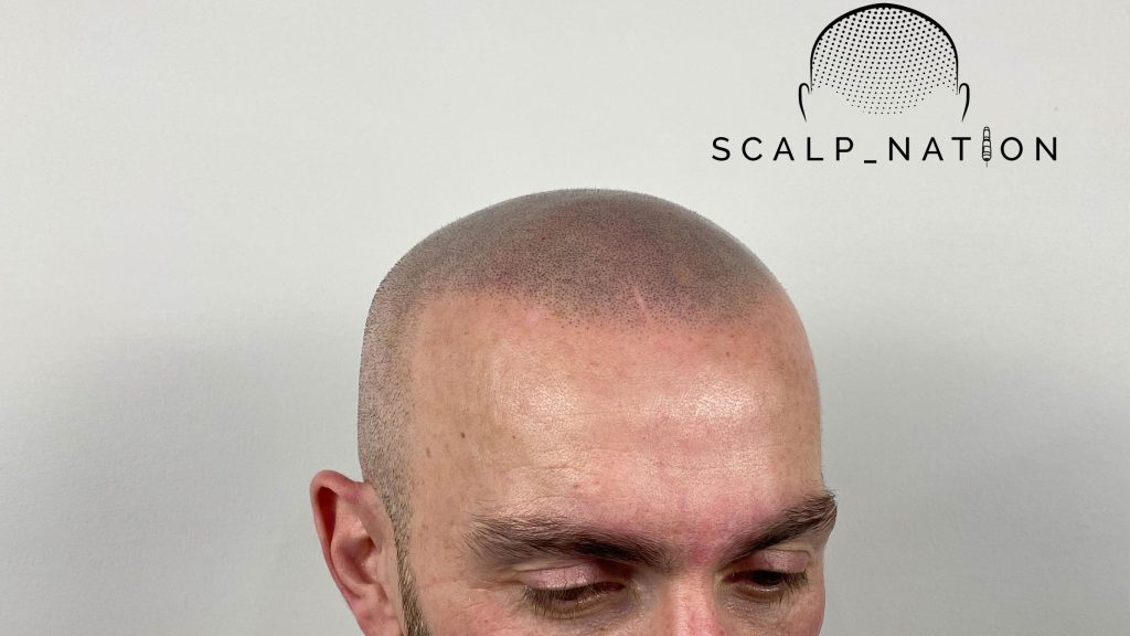 Not Sure What to Buy? 5 Reasons to Gift a Trichologist Consultation Instead of Grooming Products 1 hdf