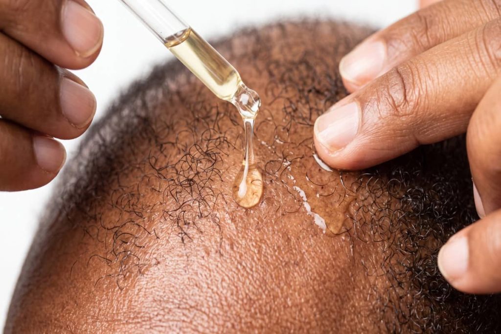 Topical treatment for afro hair thinning